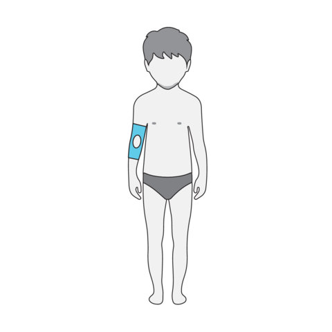 Arm immobilizers