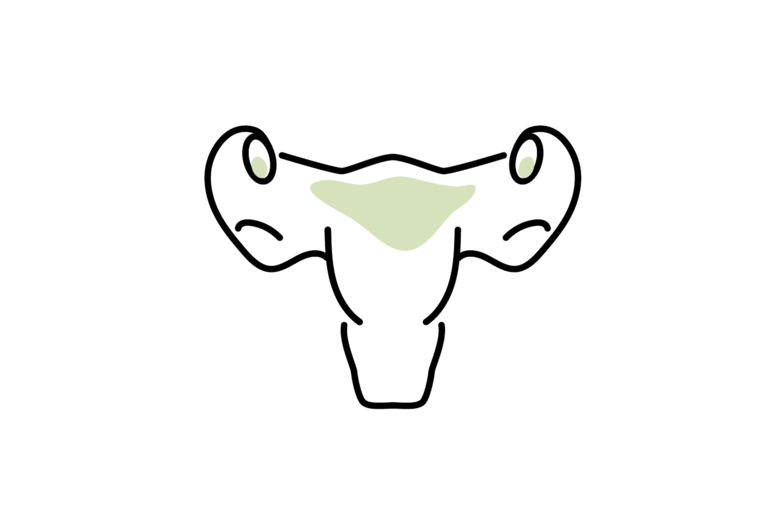 Gynaecology