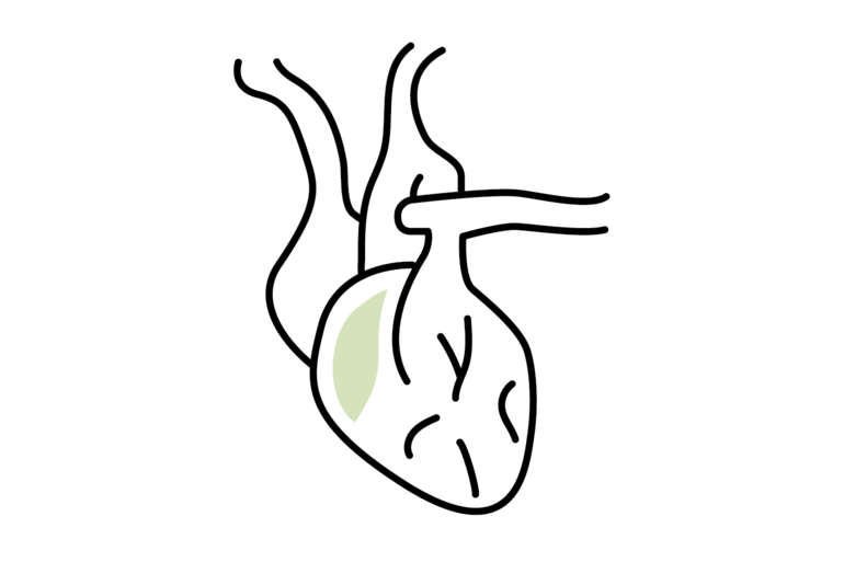 Cardiology and cardiac surgery