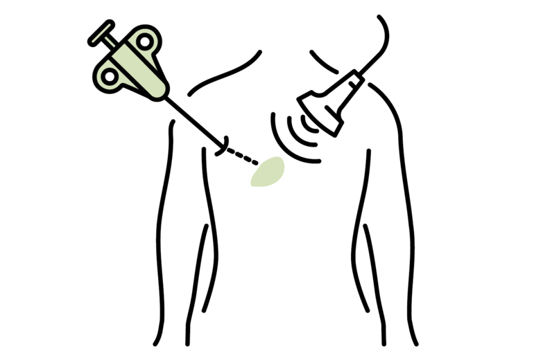 Puncture procedures and biopsy procedures
